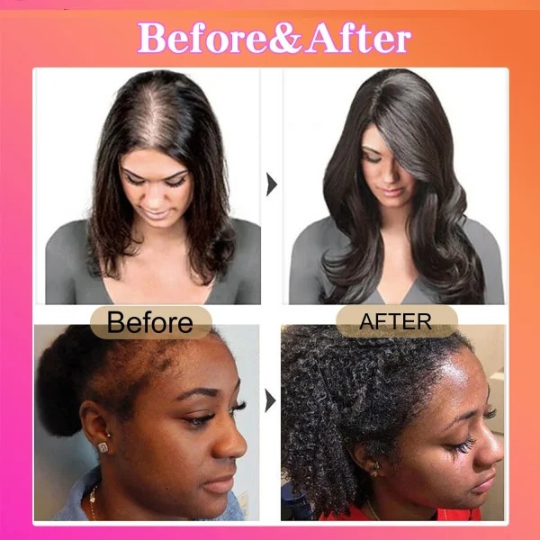 BOTANIX – Batana Natural Hair Growth Oil - Buy 1 Get 1 FREE